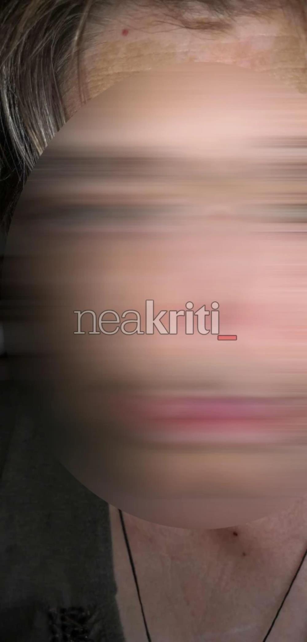 Κρήτη - ΑμεΑ - Ξυλοδαρμός Κρήτη - ΑμεΑ - Ξυλοδαρμός