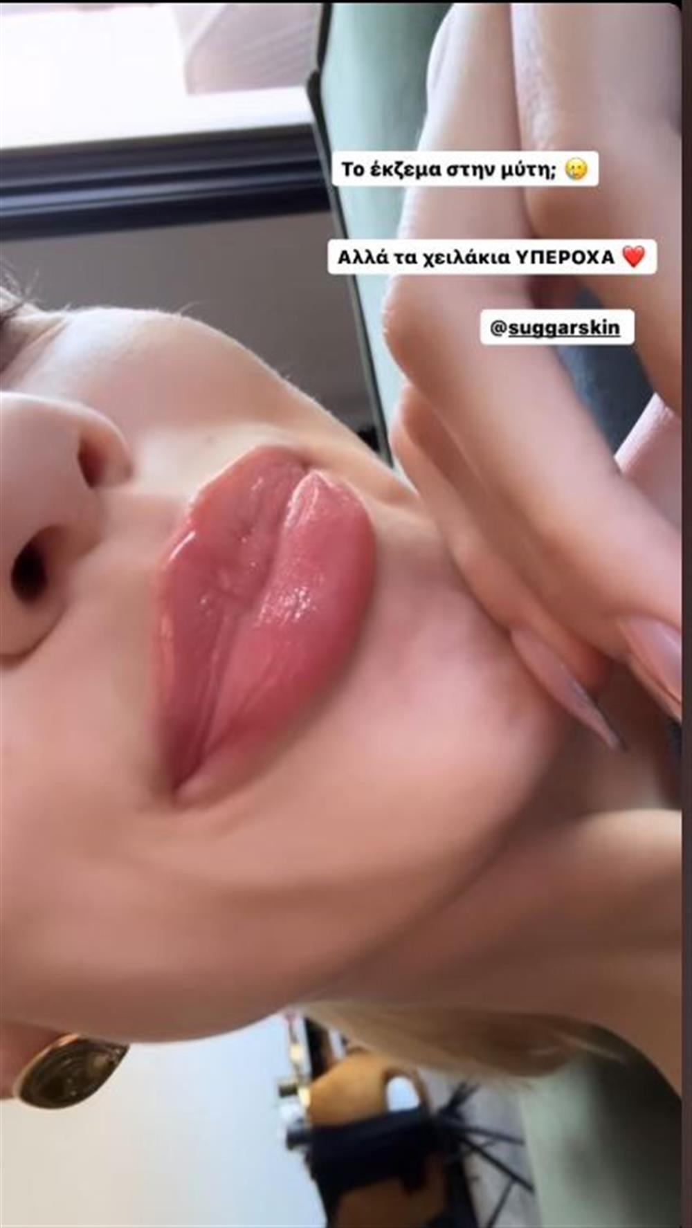 Γαρυφαλλιά Καληφώνη