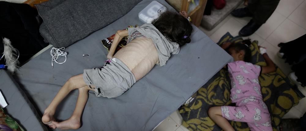 Γάζα - πόλεμος - Λωρίδα της Γάζας - υποσιτισμός Γάζα - πόλεμος - Λωρίδα της Γάζας - υποσιτισμός