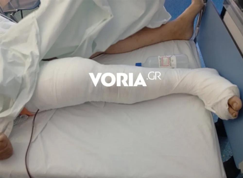 Επίθεση - ΑΜΕΑ - Αδέσποτοι - Σκύλοι Επίθεση - ΑΜΕΑ - Αδέσποτοι - Σκύλοι