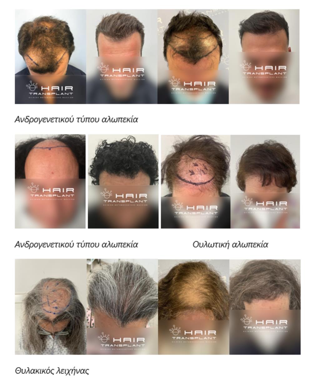 HHG - ΠΑΠΑΓΓΕΛΟΠΟΥΛΟΣ ΙΩΑΝΝΗΣ HHG - ΠΑΠΑΓΓΕΛΟΠΟΥΛΟΣ ΙΩΑΝΝΗΣ