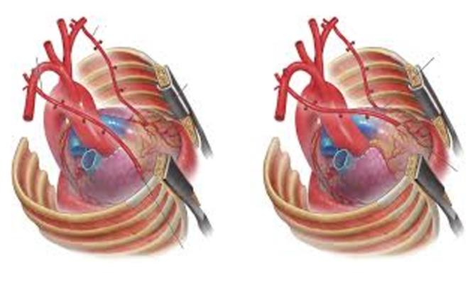 Metropolitan - Ηλιόπουλος Metropolitan - Ηλιόπουλος